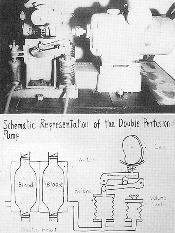 日本初の人工心臓とその作動概念図